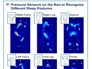 Cloud-Based Sleep Quality Monitoring System Using Pressure Sensor Grid